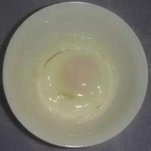 治感冒的蒸雞蛋的做法 步骤4